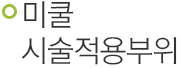 미쿨 시술 적용 부위.