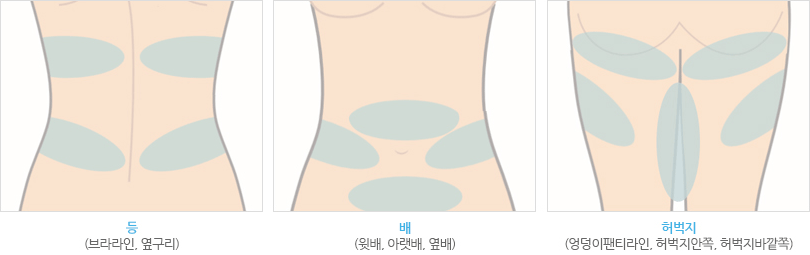 등(브라라인,옆구리). 배(윗배,아랫배,옆배). 허벅지(엉덩이팬티라인,허벅지안쪽,허벅지바깥쪽)