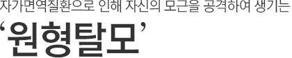 자가면역질환으로 인해 자신의 모근을 공격하여 생기는 원형탈모