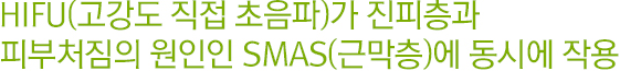 HIFU(고강도 직접 초음파)가 진피층과 피부처짐의 원인인 SMAS(근막층)에 동시에 작용.