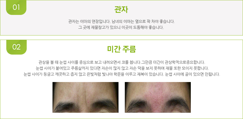 1.관자. 관자는 이마의 연장입니다. 남녀의 이마는 옆으로 꽉 차야 좋습니다. 그 곳에 재물창고가 있으니 이곳이 도톰해야 좋습니다. 2.미간 주름. 관상을 볼 때 눈썹 사이를 중심으로 보고 내려오면서 코를 봅니다. 그만큼 미간이 관상학적으로 중요합니다. 눈썹 사이가 붙어있고 주름살까지 있다면 자손이 많지 않고 자손 덕을 보지 못하며 재물 또한 모이지 못합니다. 눈썹 사이가 둥글고 깨끗하고 좁지 않고 은빛처럼 빛나야 학문을 이루고 재복이 있습니다. 눈썹 사이에 골이 있으면 안됩니다. 미간주름 전후 사진.