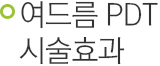 여드름 PDT 시술 효과