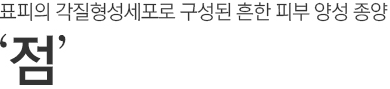 표피의 각질형성세포로 구성된 흔한 피부 양성 종양. 점