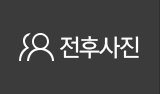 전후사진