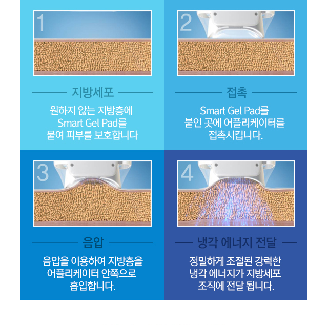 1.지방세포=원하지 않는 지방층에 Smart Gel Pad를 붙여 피부를 보호합니다. 2.접촉=Smart Gel Pad를 붙인 곳에 어플리케이터를 접촉시킵니다. 3.음압=음압을 이용하여 지방층을 어플리케이터 안쪽으로 흡입합니다. 4.냉각 에너지 전달=정밀하게 조절된 강력한 냉각 에너지가 지방세포 조직에 전달됩니다.