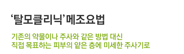 탈모클리닉 메조요법. 기존의 약물이나 주사와 같은 방법 대신 직접 목표하는 피부의 얕은 층에 미세한 주사기로