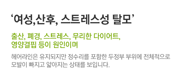여성,산후,스트레스성 탈모. 출산,폐경,스트레스,무리한 다이어트,영양결핍 등이 원인이며. 헤어라인은 유지되지만 정수리를 포함한 두정부 부위에 전체적으로 모발이 빠지고 얇아지는 상태를 보입니다.