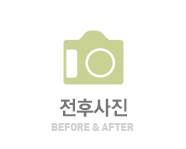 전후사진
