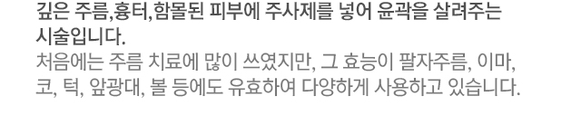 깊은 주름,흉터,함몰된 피부에 주사제를 넣어 윤곽을 살려주는 시술입니다. 처음에는 주름 치료에 많이 쓰였지만, 그 효능이 팔자주름, 이마, 코, 턱, 앞광대, 볼 등에도 유효하여 다양하게 사용하고 있습니다.