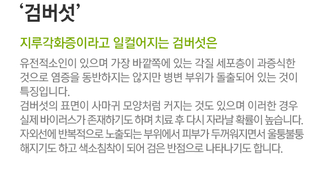 검버섯. 지루각화증이라고 일컬어지는 검버섯은 유전적소인이 있으며 가장 바깥쪽에 있는 각질 세포층이 과증식한 것으로 염증을 동반하지는 않지만 병변 부위가 돌출되어 있는 것이 특징입니다. 검버섯의 표면이 사마귀 모양처럼 커지는 것도 있으며 이러한 경우 실제 바이러스가 존재하기도 하며 치료 후 다시 자라날 확률이 높습니다. 자외선에 반복적으로 노출되는 부위에서 피부가 두꺼워지면서 울퉁불퉁해지기도 하고 색소침착이 되어 검은 반점으로 나타나기도 합니다.