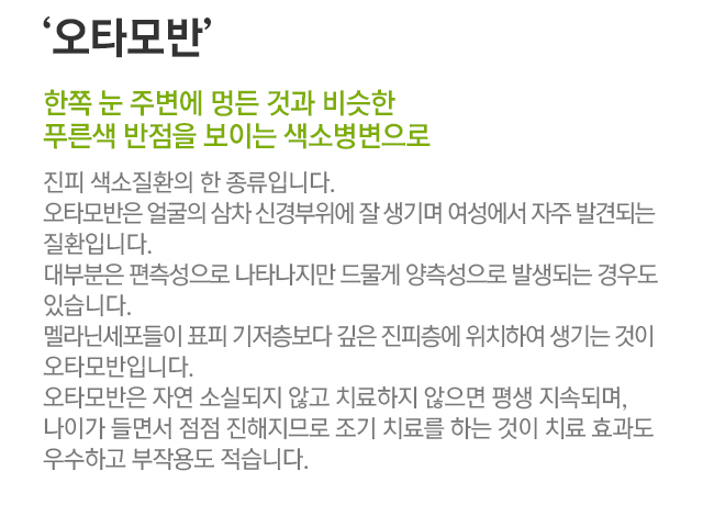 오타모반. 한쪽 눈 주변에 멍든 것과 비슷한 푸른색 반점을 보이는 색소병변으로. 진피 색소질환의 한 종류입니다. 오타모반은 얼굴의 삼차 신경부위에 잘 생기며 여성에서 자주 발견되는 질환입니다. 대부분은 편측성으로 나타나지만 드물게 양측성으로 발생되는 경우도 있습니다. 멜라닌 세포들이 표피 기저층보다 깊은 진피층에 위치하여 생기는 것이 오타모반입니다. 오타모반은 자연 소실되지 않고 치료하지 않으면 평생 지속되며, 나이가 들면서 점점 진해지므로 조기 치료를 하는 것이 치료 효과도 우수하고 부작용도 적습니다.