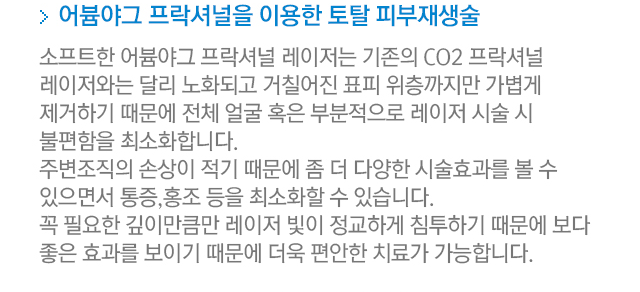 어븀야그 프락셔널을 이용한 토탈 피부재생술. 소프트한 어븀야그 프락셔널 레이저는 기존의 CO2 프락셔널 레이저와는 달리 노화되고 거칠어진 표피 위층까지만 가볍게 제거하기 때문에 전체 얼굴 혹은 부분적으로 레이저 시술 시 불편함을 최소화합니다. 주변조직의 손상이 적기 때문에 좀 더 다양한 시술효과를 볼 수 있으면서 통증, 홍조 등을 최소화할 수 있습니다. 꼭 필요한 깊이만큼만 렝디저 빛이 정교하게 침투하기 때문에 보다 좋은  효과를 보이기 때문에 더욱 편안한 치료가 가능합니다.