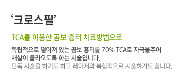 크로스필. TCA를 이용한 곰보 흉터 치료방법으로. 독립적으로 떨어져 있는 곰보 흉터를 70% TCA로 자극을 주어 새살이 올라오도록 하는 시술입니다. 단독 시술을 하기도 하고 레이저와 복합적으로 시술하기도 합니다.