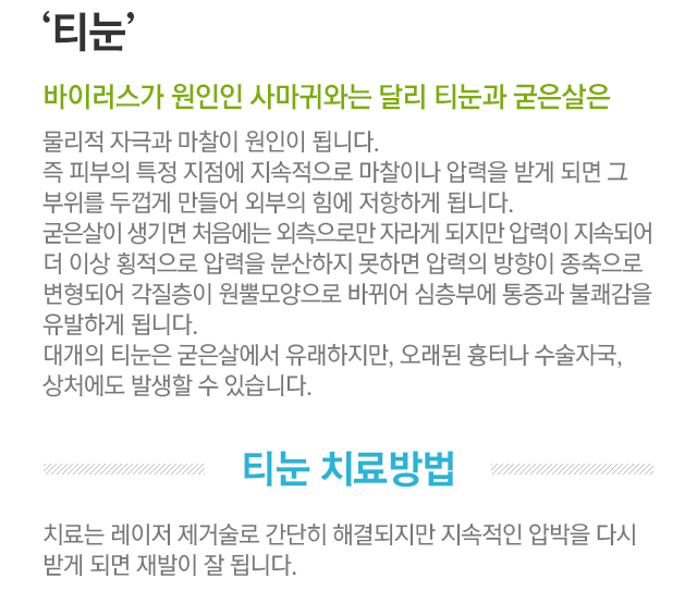 티눈. 바이러스가 원인인 사마귀와는 달리 티눈과 굳은 살은 물리적 자극과 마찰이 원인이 됩니다. 즉 피부의 특정 지점에 지속적으로 마찰이나 압력을 받게 되면 그 부위를 두껍게 만들어 외부의 힘에 저항하게 됩니다. 굳은 살이 생기면 처음에는 외측으로만 자라게 되지만, 압력이 지속되어 더 이상 횡적으로 압력을 분산하지 못하면 압력의 방향이 종축으로 변형되어 각질층이 원뿔 모양으로 바뀌어 심층부에 통증과 불쾌감을 유발하게 됩니다. 대개의 티눈은 굳은 살에서 유래하지만, 오래된 흉터나 수술자국, 상처에도 발생할 수 있습니다. 티눈 치료방법. 치료는 레이저 제거술로 간단히 해결되지만 지속적인 압박을 다시 받게되면 재발이 잘 됩니다.